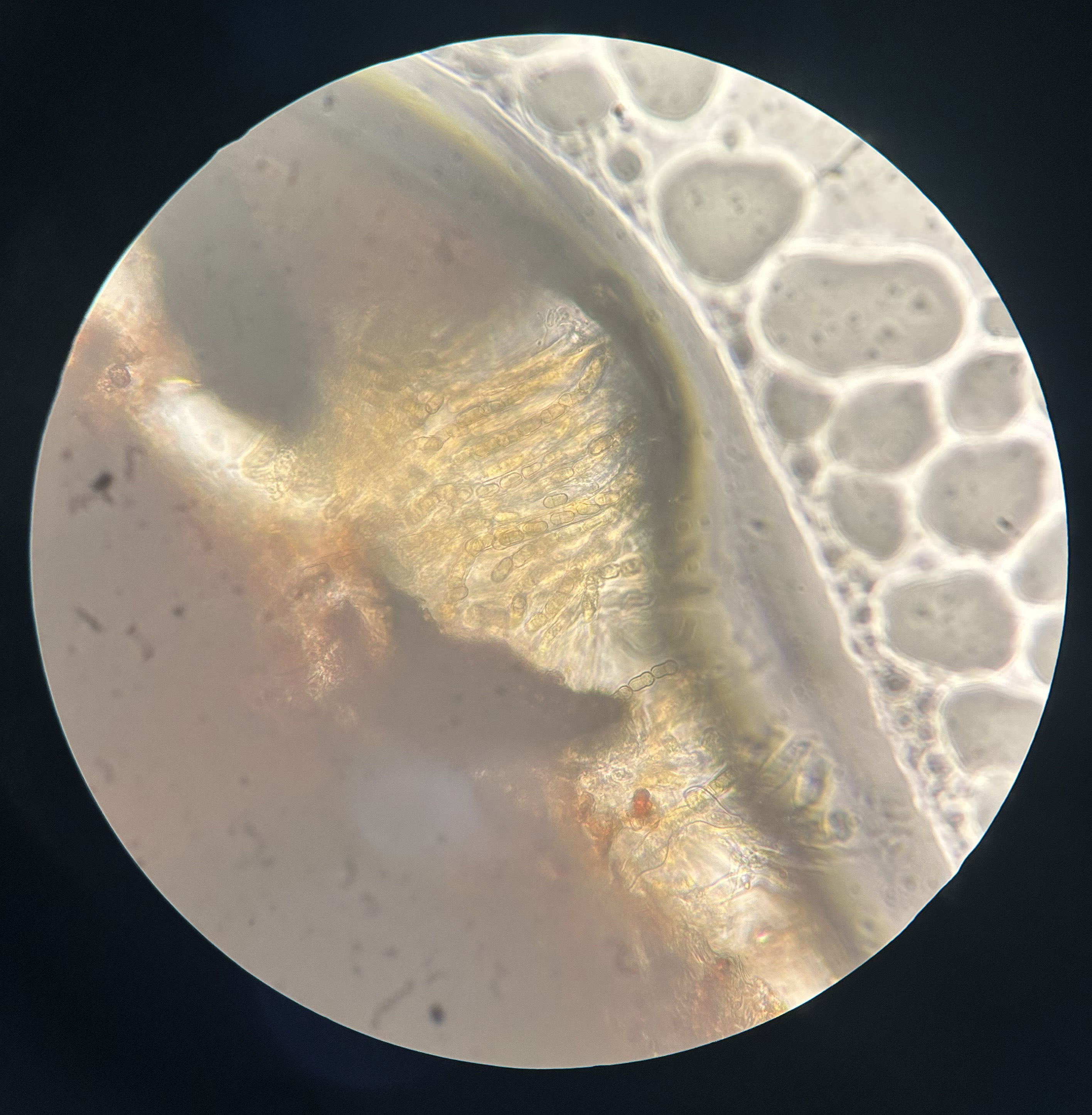Apple scab ascospores under a miscroscope.